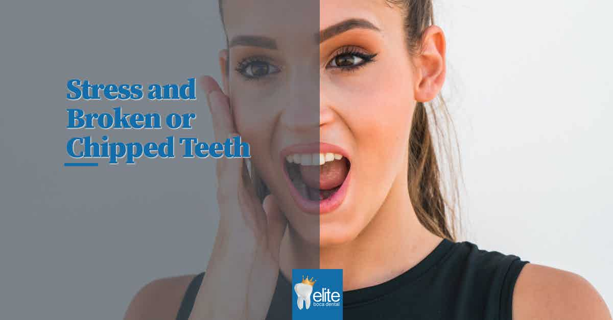 Teeth Whitening Myths